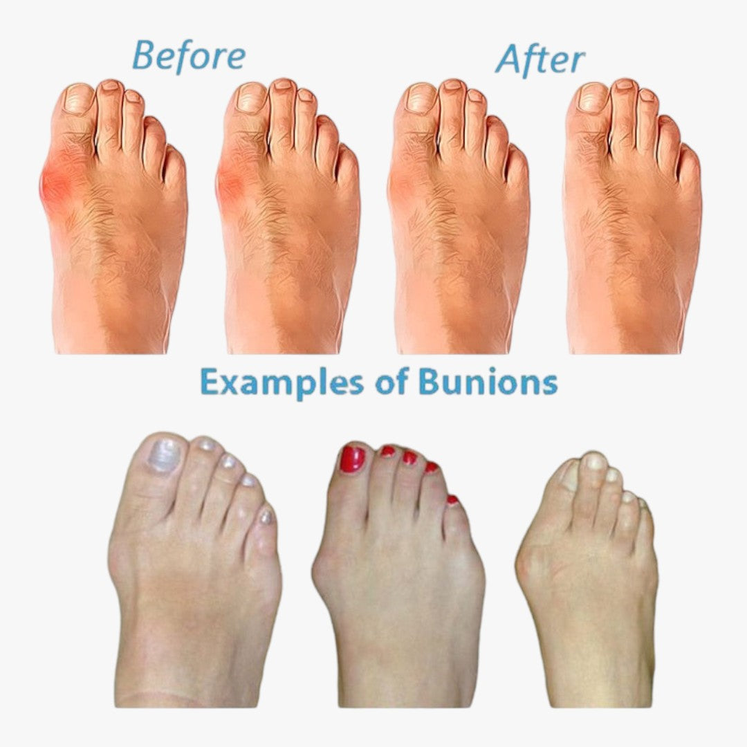 Miles & Luna Correcting Sandals for Women